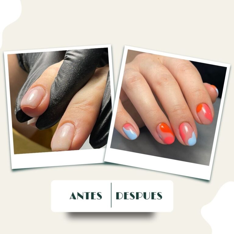 Antes y despues Mazur