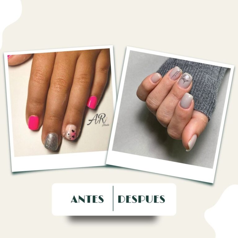 Antes y despues Mazur