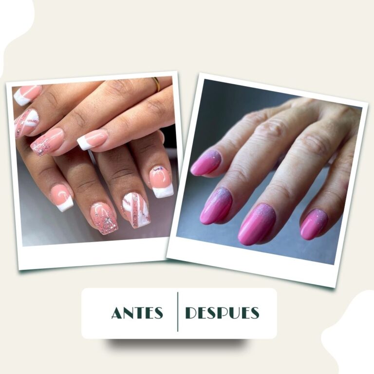 Antes y despues Mazur